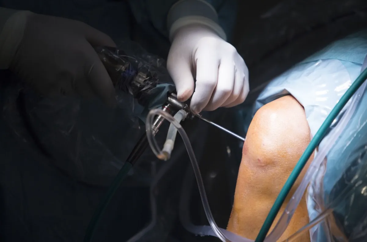 Knee Arthroscopy in Nagpur for Quick Recovery and ...