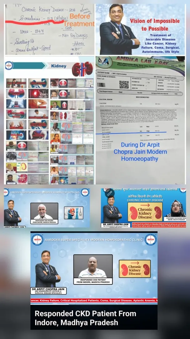 Chronic Kidney Disease CKD Patient responded & Hig...