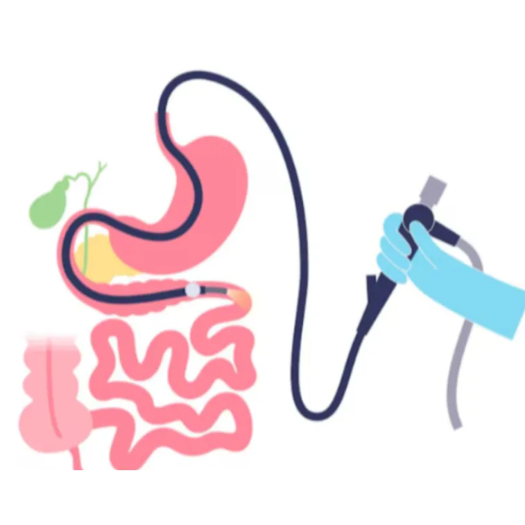 Double Balloon Enteroscopy: A Diagnostic Breakthro...
