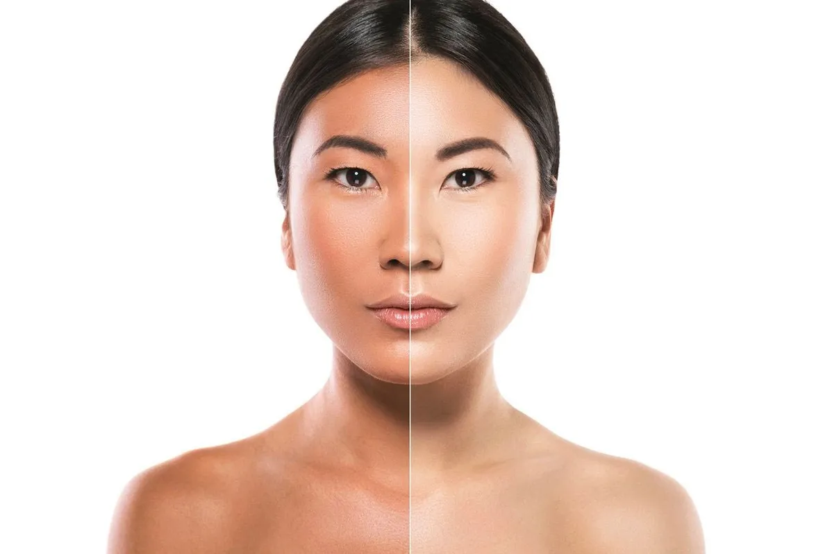 Skin Whitening In Janakpuri
At Aishanya Aesthet...