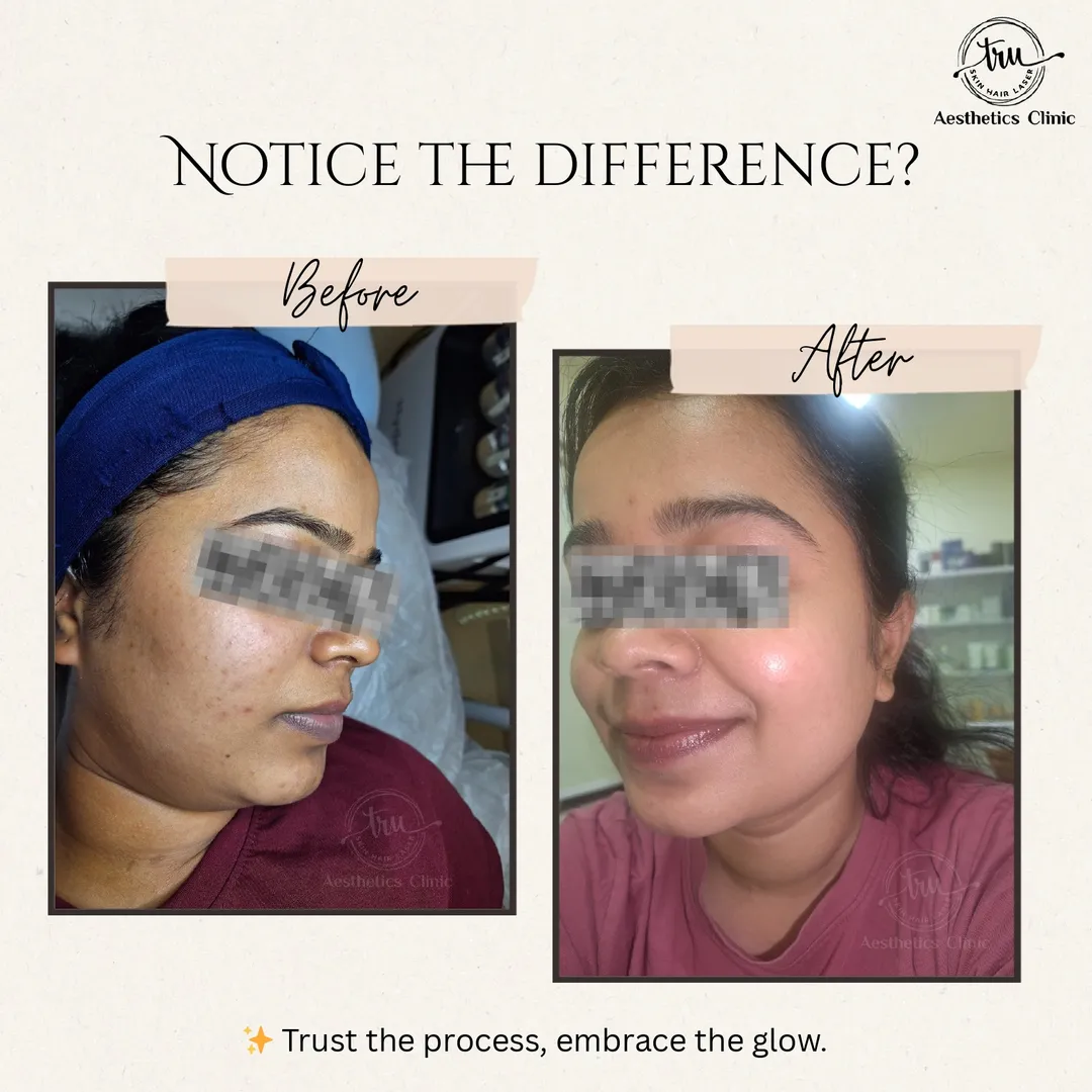 ✨ Great skin isn’t a coincidence — it’s consistenc...