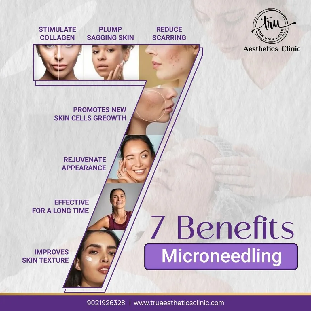 ✨ Unlock Radiant, Youthful Skin with Microneedling...