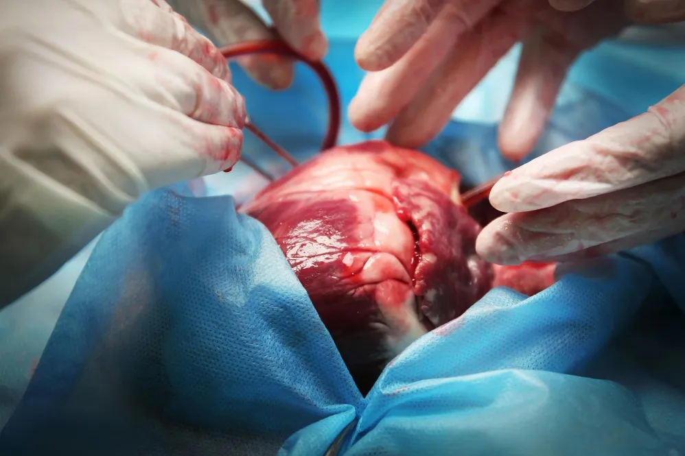 Best Cardiac Surgeon in Pune – Skilled Hands for H...