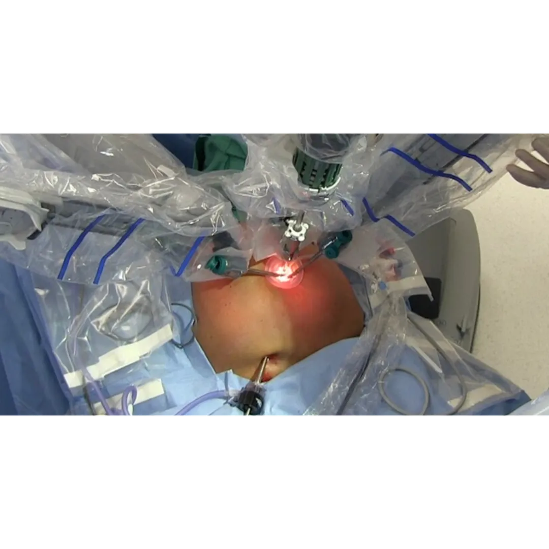 Trusted Robotic Liver Cancer Surgery Specialist Cl...