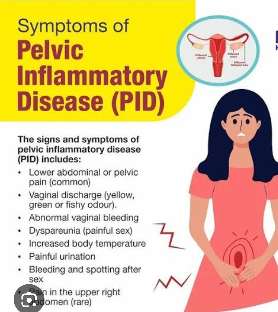 Pelvic Inflammatory Disease (PID) is an infection ...