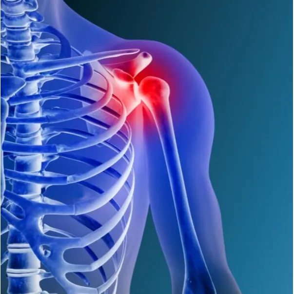 Rotator Cuff Repair Surgery in North Bangalore: Re...