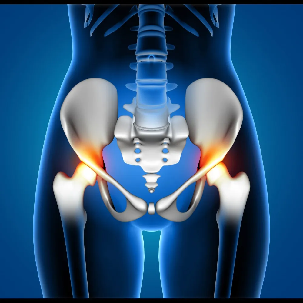 Hip Replacement Surgery in Noida: Enhancing Qualit...
