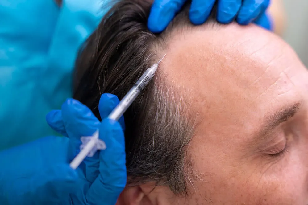 What are the expected benefits of PRP treatment fo...