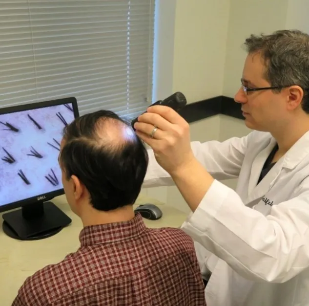 How is the PRP for hair loss prepared, and is the ...
