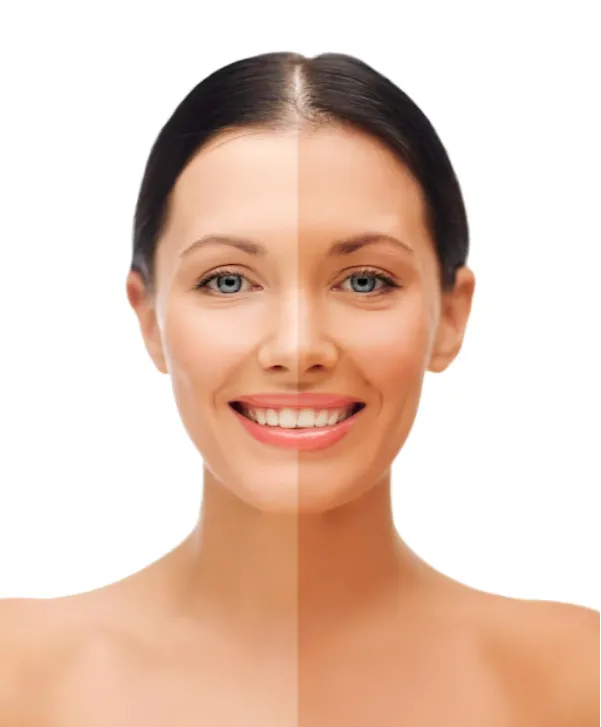 Skin Toning Treatment in Kolshet Road – Achieve Ev...