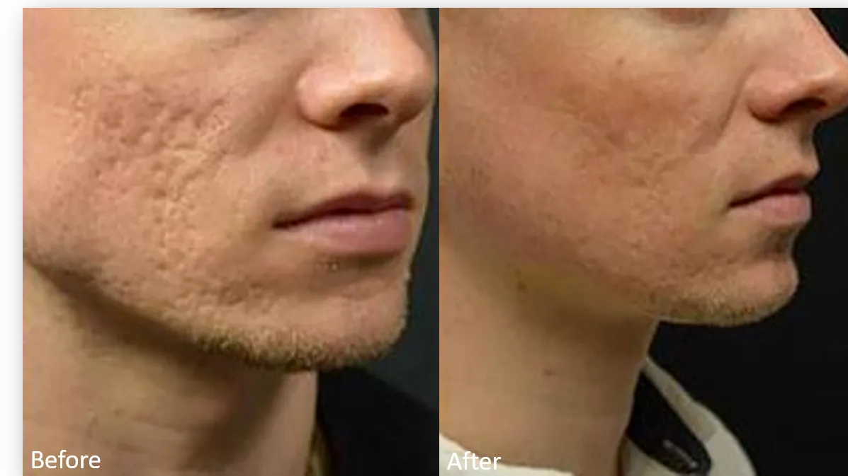 💎 Reveal Clearer Skin with MNRF! 💎
Don't just resu...