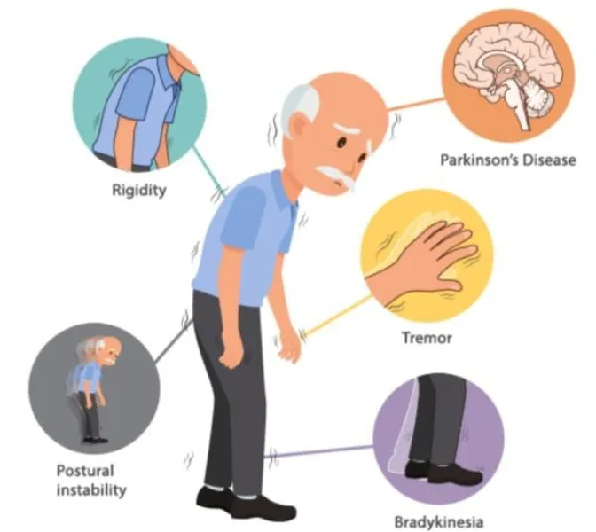 Best Homoeopathic Doctor for Parkinson Disease in ...