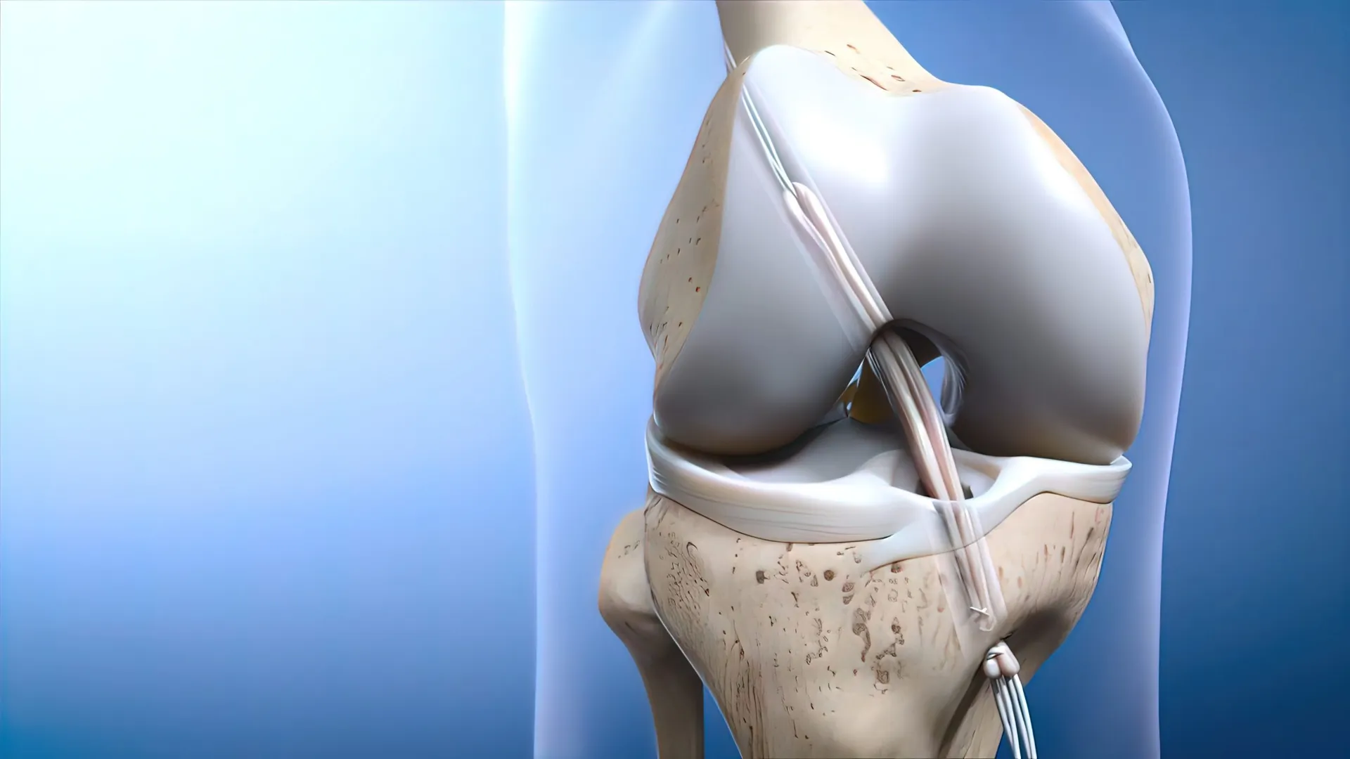 Advanced Arthroscopic ACL Repair Surgery by Dr. Ku...