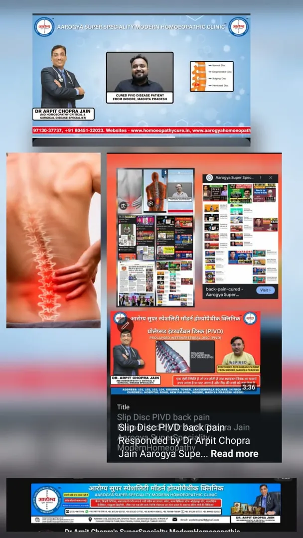 Slipped Disc स्लिप्ड डिस्क PIVD Back pain Cured in...