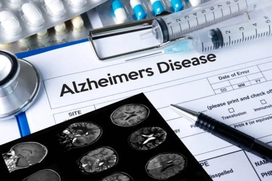 Best Homoeopathic Doctor for Alzheimer Disease in ...