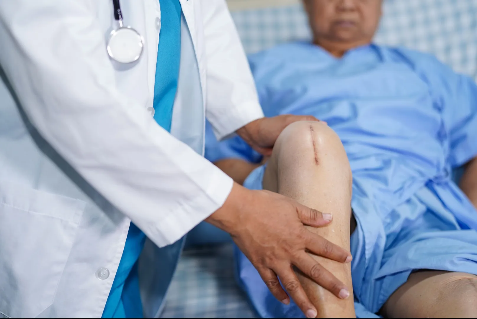 Fast-Track Knee Replacement in Delhi – Get Back on...