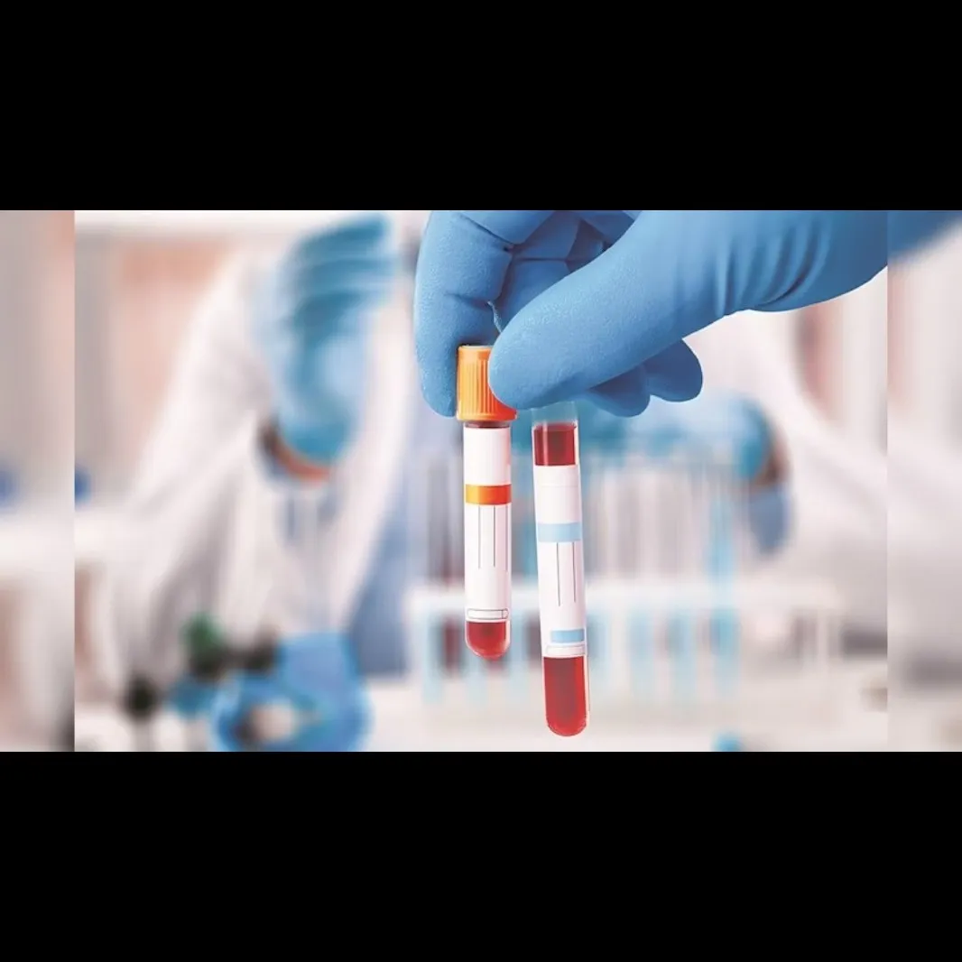 Finding Pathology Lab in Pimple Saudagar ? Blood T...