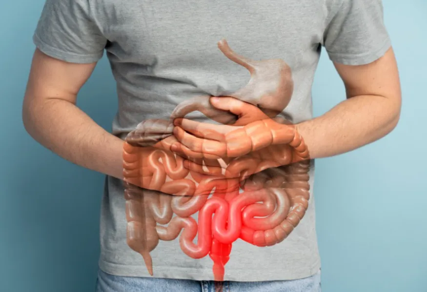 Adalimumab for Effective IBD Management in Mumbai ...