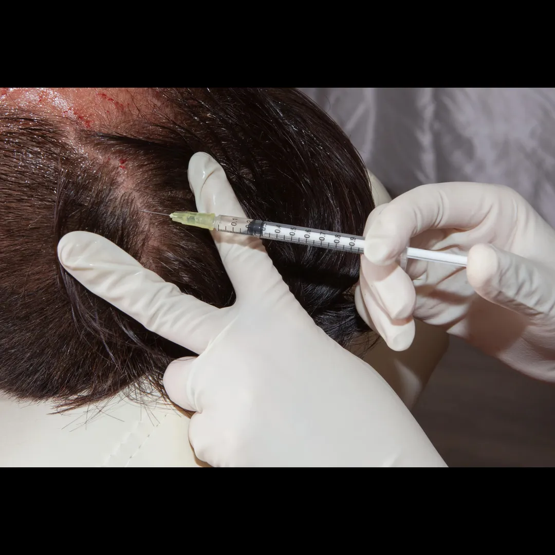 Regrow Hair Treatment in Delhi
Facing hair thinni...