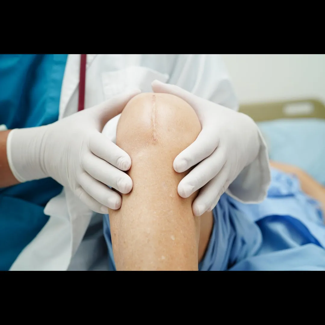 Joint Replacement Near Thiruvanmiyur – Precision S...