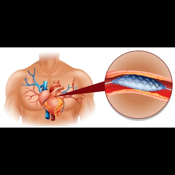Endovascular Specialist in Pune – Minimally Invasi...