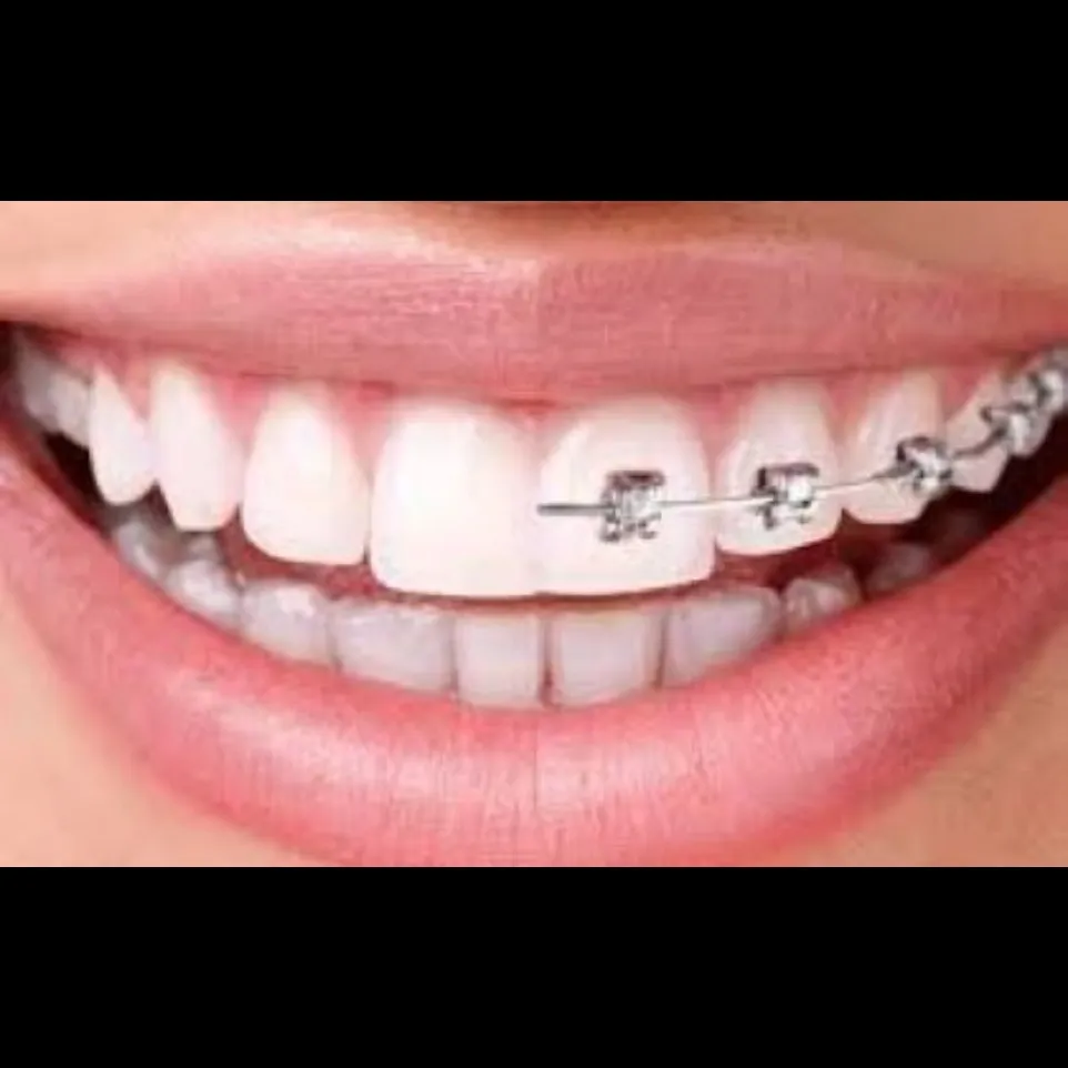 Orthodontic Treatment in Greater Noida West with D...
