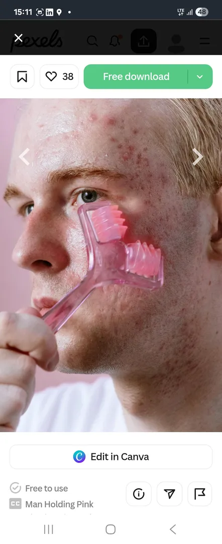 Reveal Clearer Skin with Chemical Peels for Acne @...