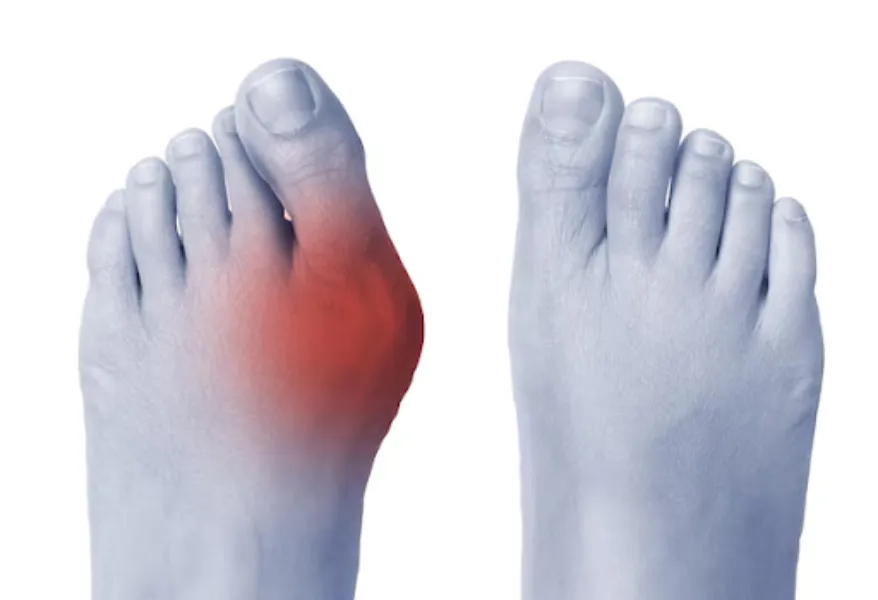 Bone Deformity Treatment in Nagpur – Restoring Function and Mobil...
