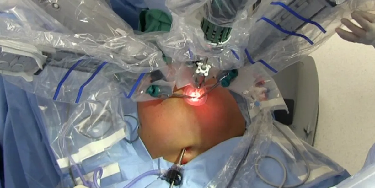 Advanced Robotic Liver Resection in Hesaraghatta – Precise, Safer Hepatic Surg...
