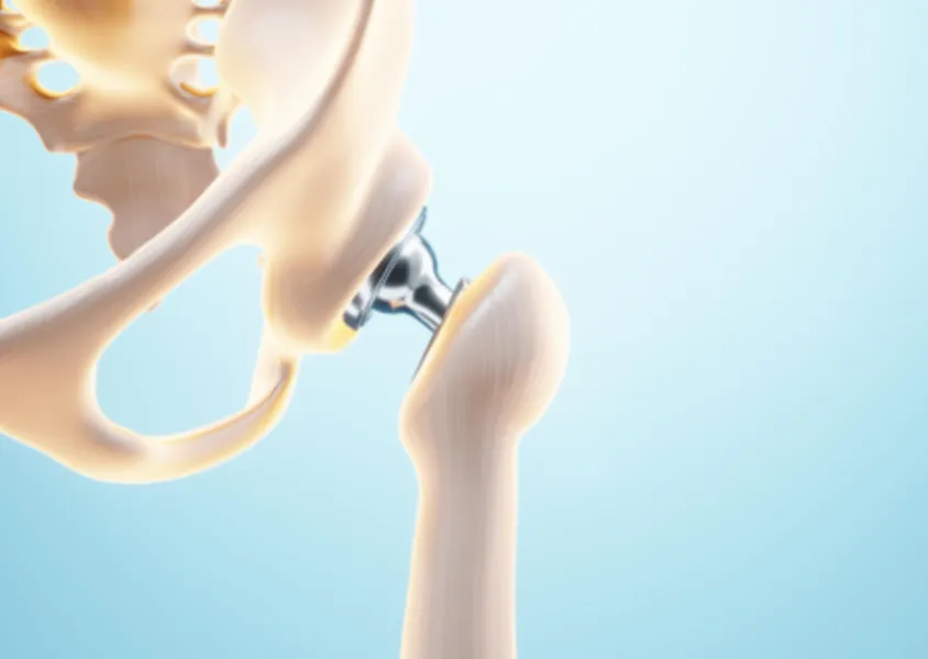 Hip Replacement Surgeon in Pimpri Chinchwad – Restoring Hip Function and Mobil...