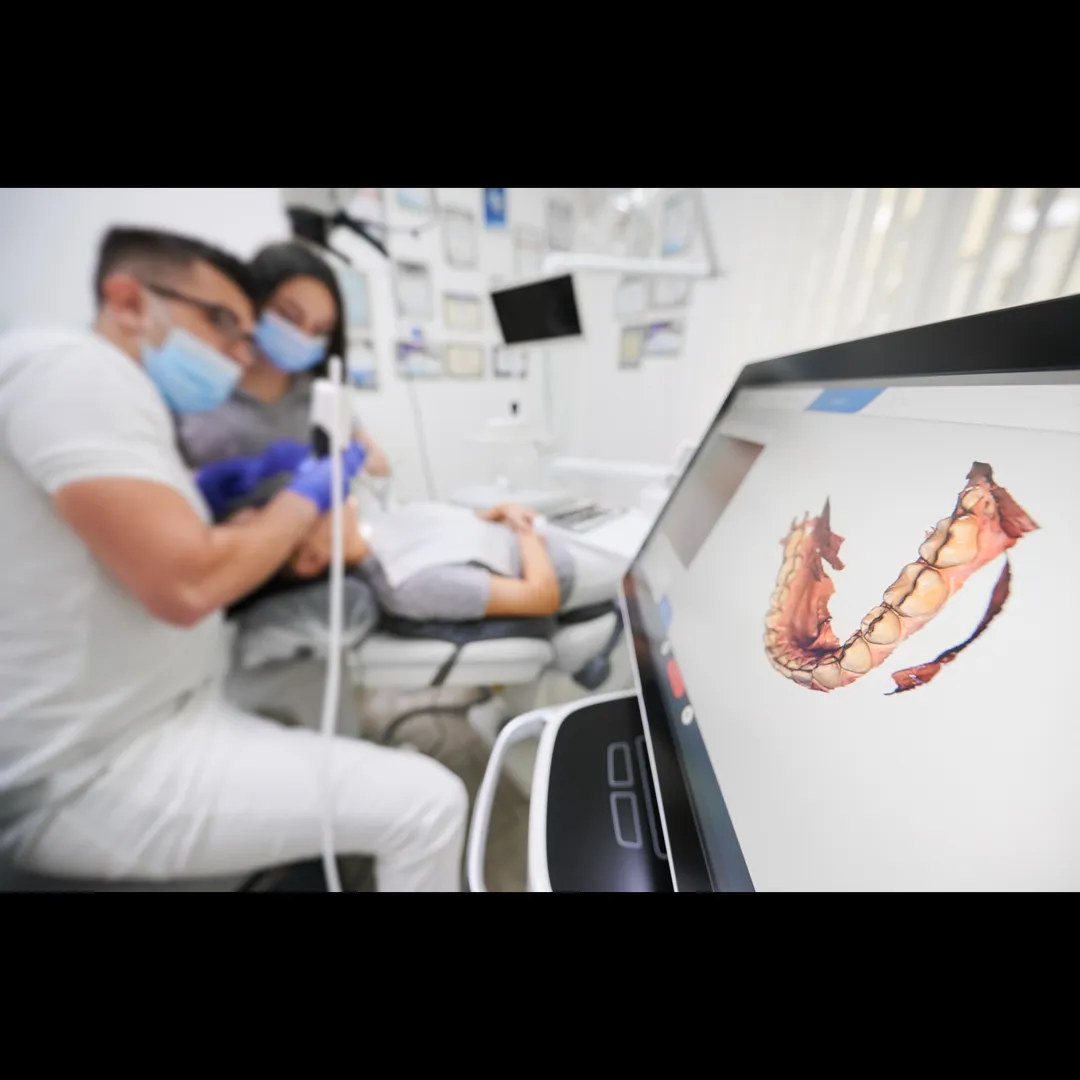Dental scanning refers to the use of specialized digital devices to create 3D images of a patient's ...