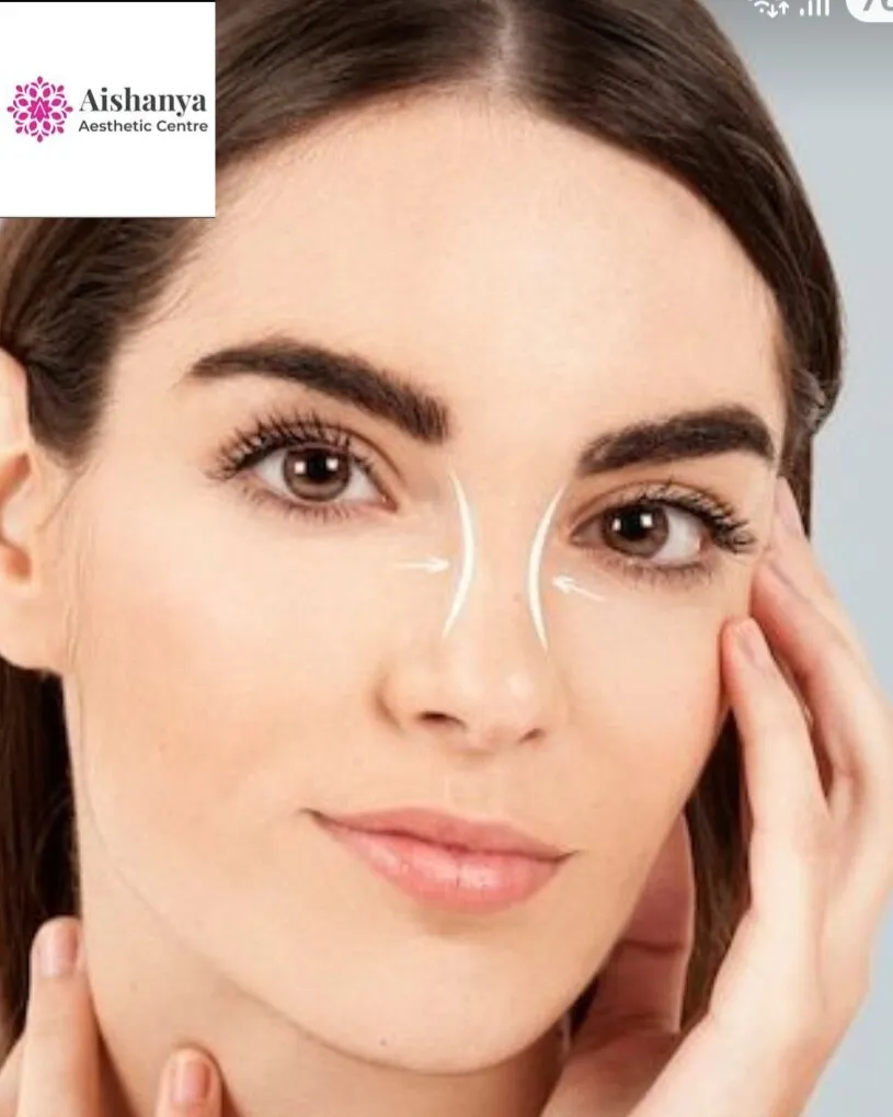 Open Rhinoplasty in Delhi Dwarka and Janakpuri