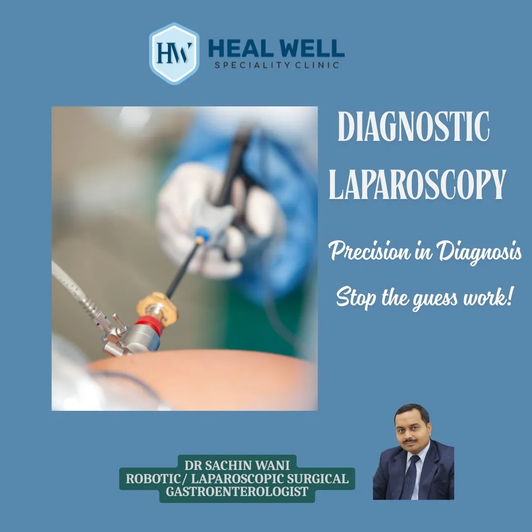 Diagnostic Laparoscopy in Thane – Precision Diagnosis for Abdominal Conditi...