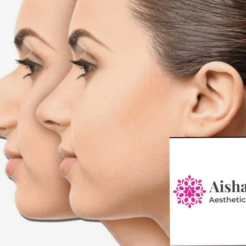 Best Revision Rhinoplasty at Aishanya Aesthetic Cen...