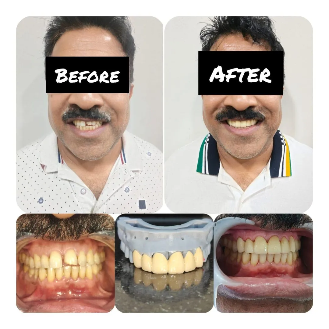Title: Trusted Dental Clinic in Sadashivanagar, Bangal...