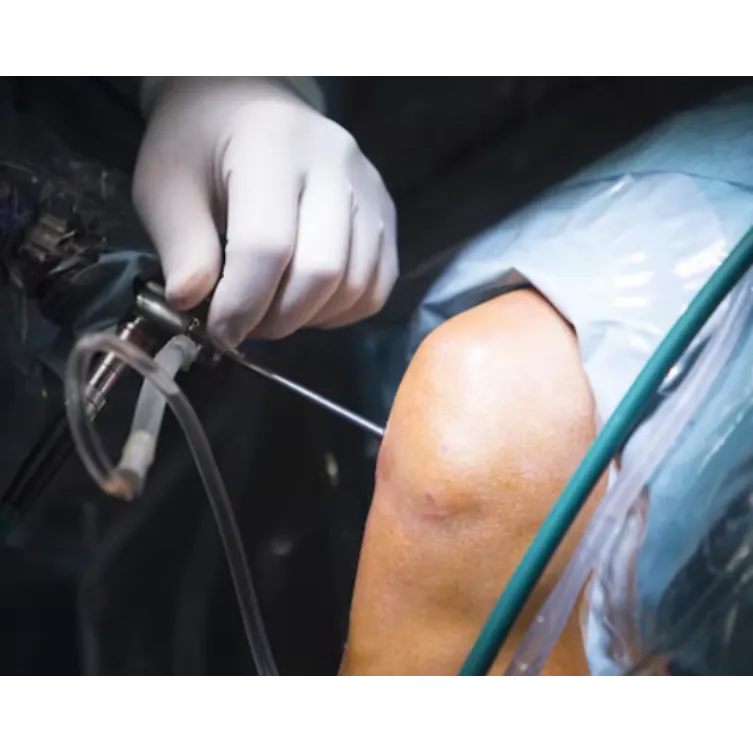 Knee Replacement in Noida