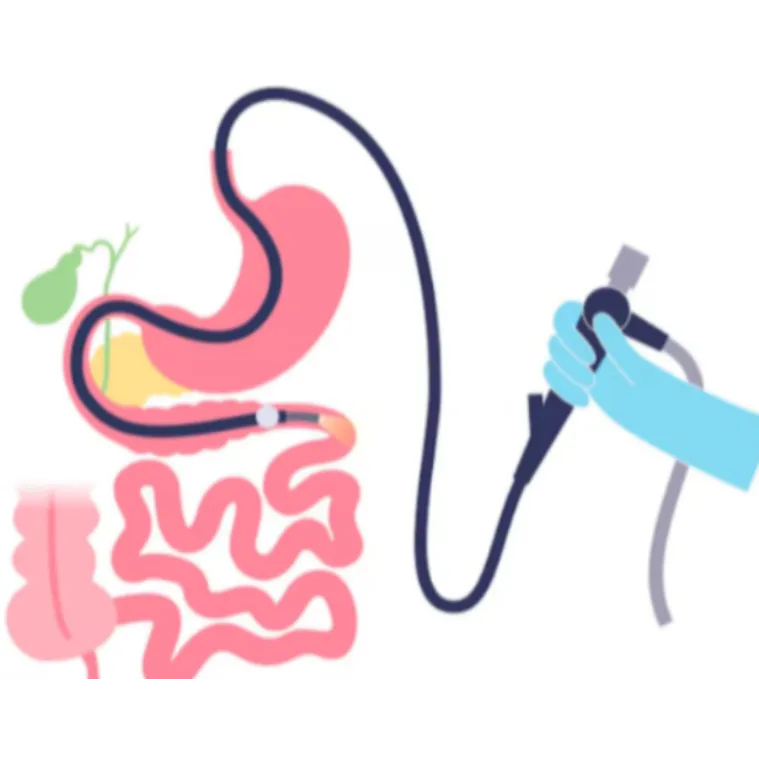 Double Balloon Enteroscopy in Mumbai