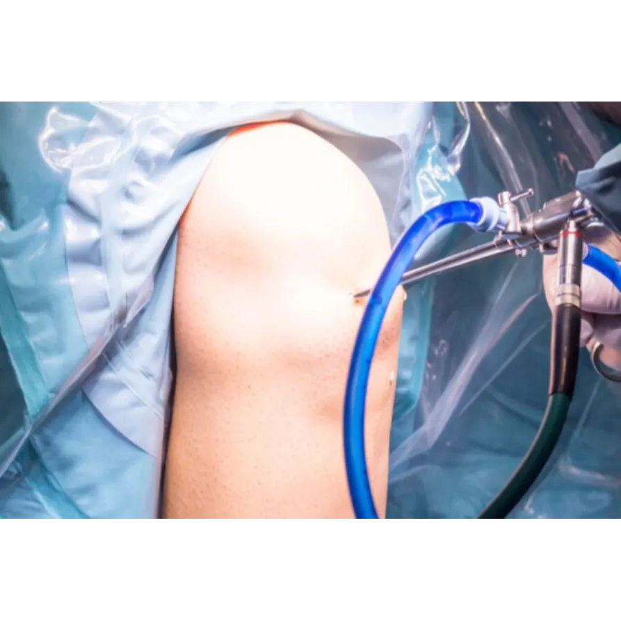 ACL Surgery in Noida