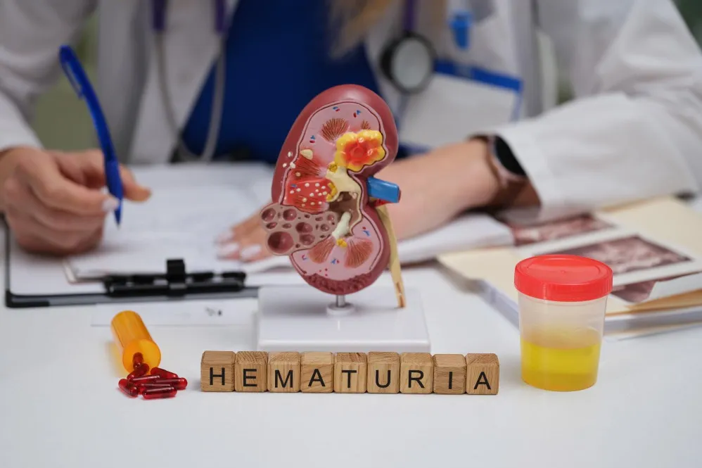 Blood in Urine Treatment Thane West – Address Early Signs with Expert Attent...