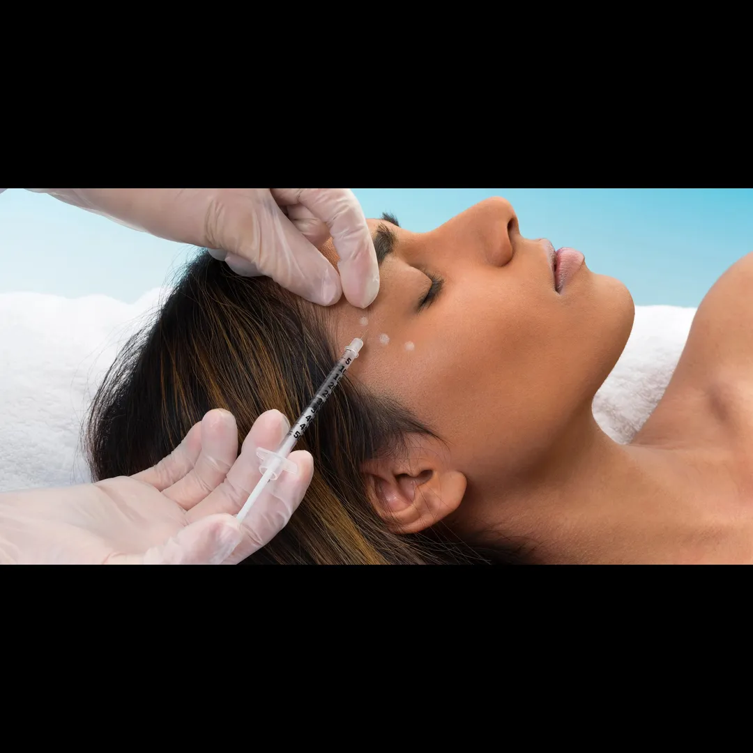 Dermal Fillers in Delhi