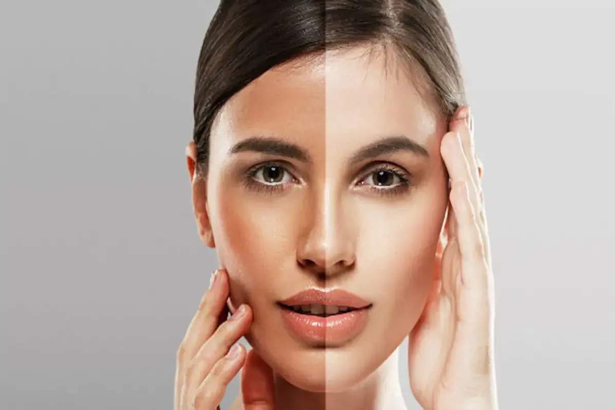 Skin Lightening Treatment in Delhi