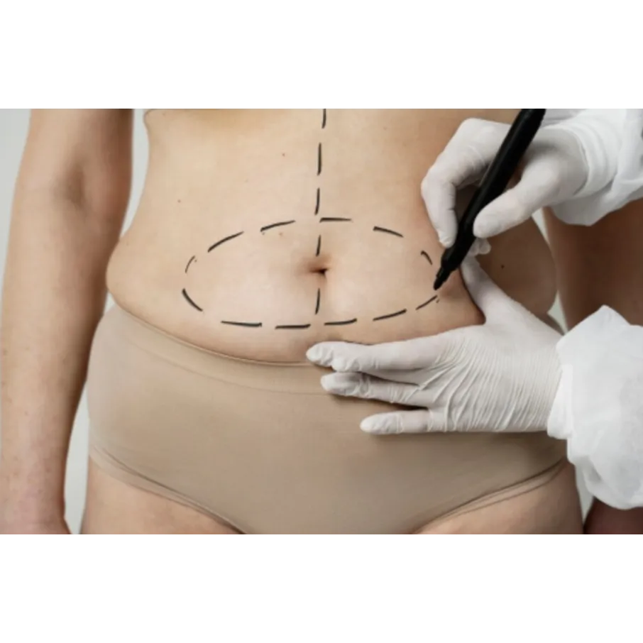 Liposuction in Bangalore – Sculpt Your Body with Precision and C...
