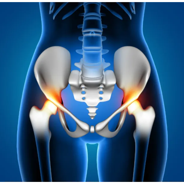Hip Replacement in Noida