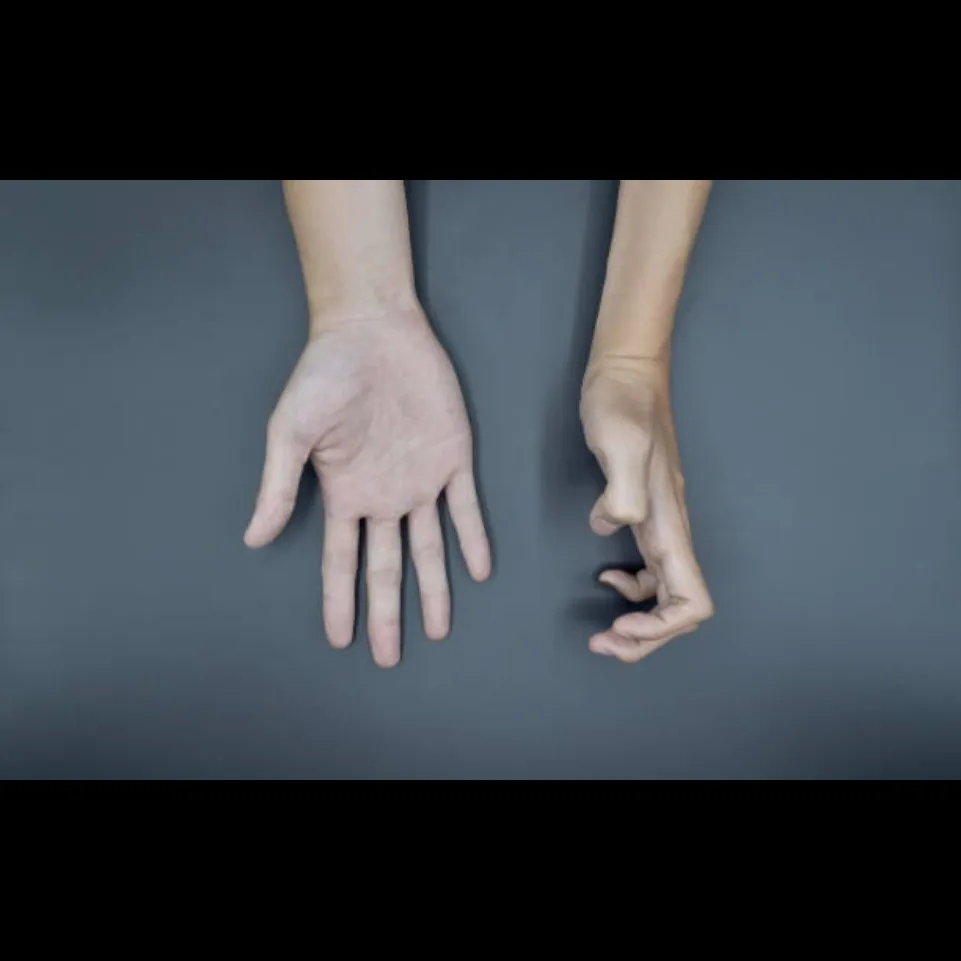 Best Surgeon for Congenital & Acquired Hand Deformities