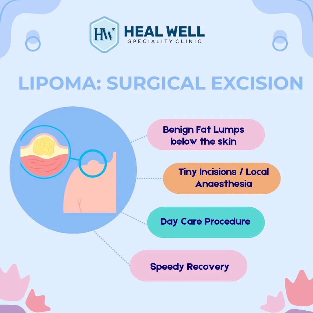 Lipoma Surgical Excision in Thane