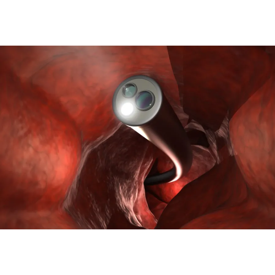 ESD (Endoscopic Submucosal Dissection) in Mumbai