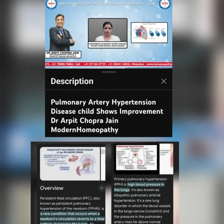 Primary Pulmonary Hypertension (PPH) & Persistant Pulmonary Hypertension of Newborn(PPHN) Responded ...