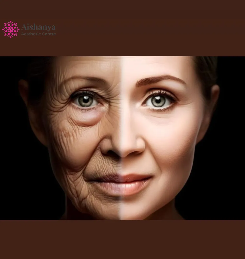 Best Botox Results in Dwarka @Aishanya Aesthetic Centre