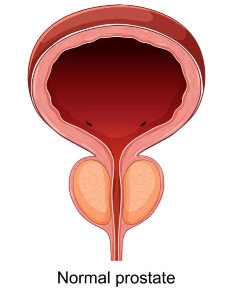 Prostate Treatment in Thane West: Modern Solutions for Men's Health