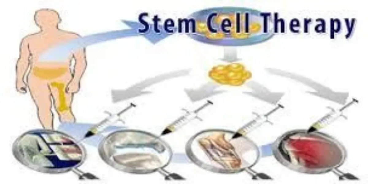 BMAC Stem Cell Therapy for Cartilage in Bangalore – Natural Regeneration for Joint Health